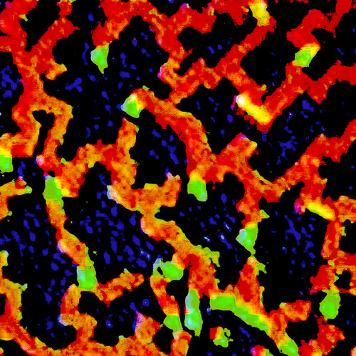 Zirconera Clutteredeta