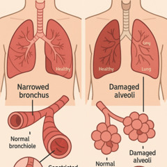 Asthma vs Emphysema | What’s Really Affecting Your Breathing