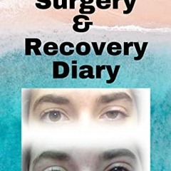 ( RTPYK ) Eyelift Surgery and Recovery Diary: Ptosis, eyelifts, punctal plugs, and dry eyes by  Kady