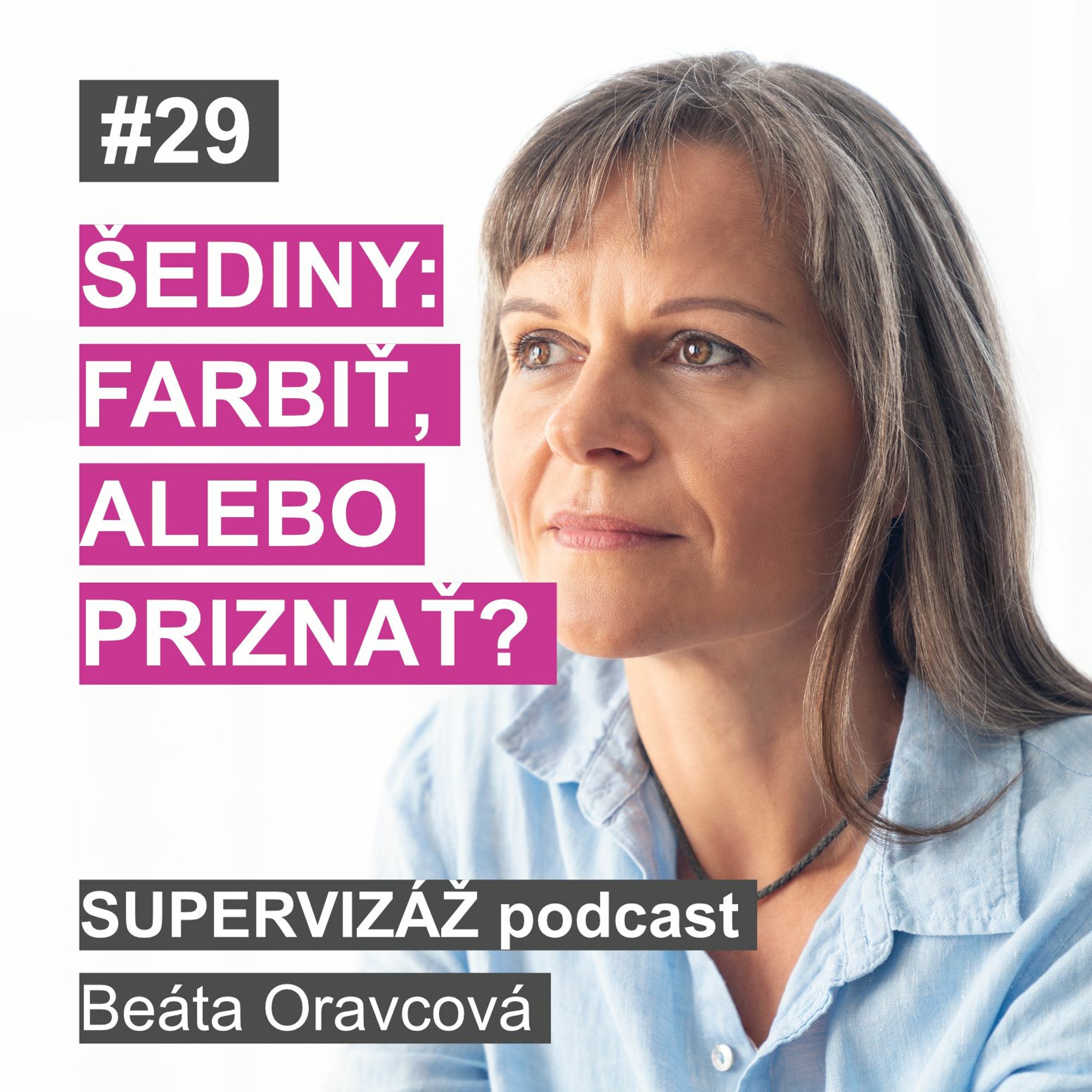 Supervizáž