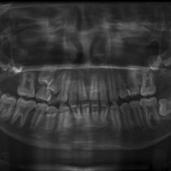 Incisor (Bleed Mix)