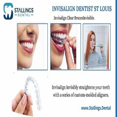 Invisalign Treatment – best dentist in St. Louis