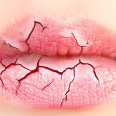 The koxx - 부르튼 (covered by Vadeem)