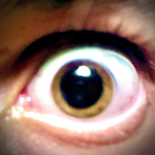 Calyx - Are you ready (Hive & Gridlok RMX)