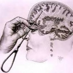 Me after the lobotomy.