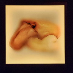 METAMORFOSIS