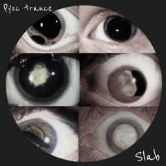 #03 Psychedelic Trance | Slab