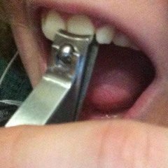 Teeth (Dubstep's Most Pretentious Track)