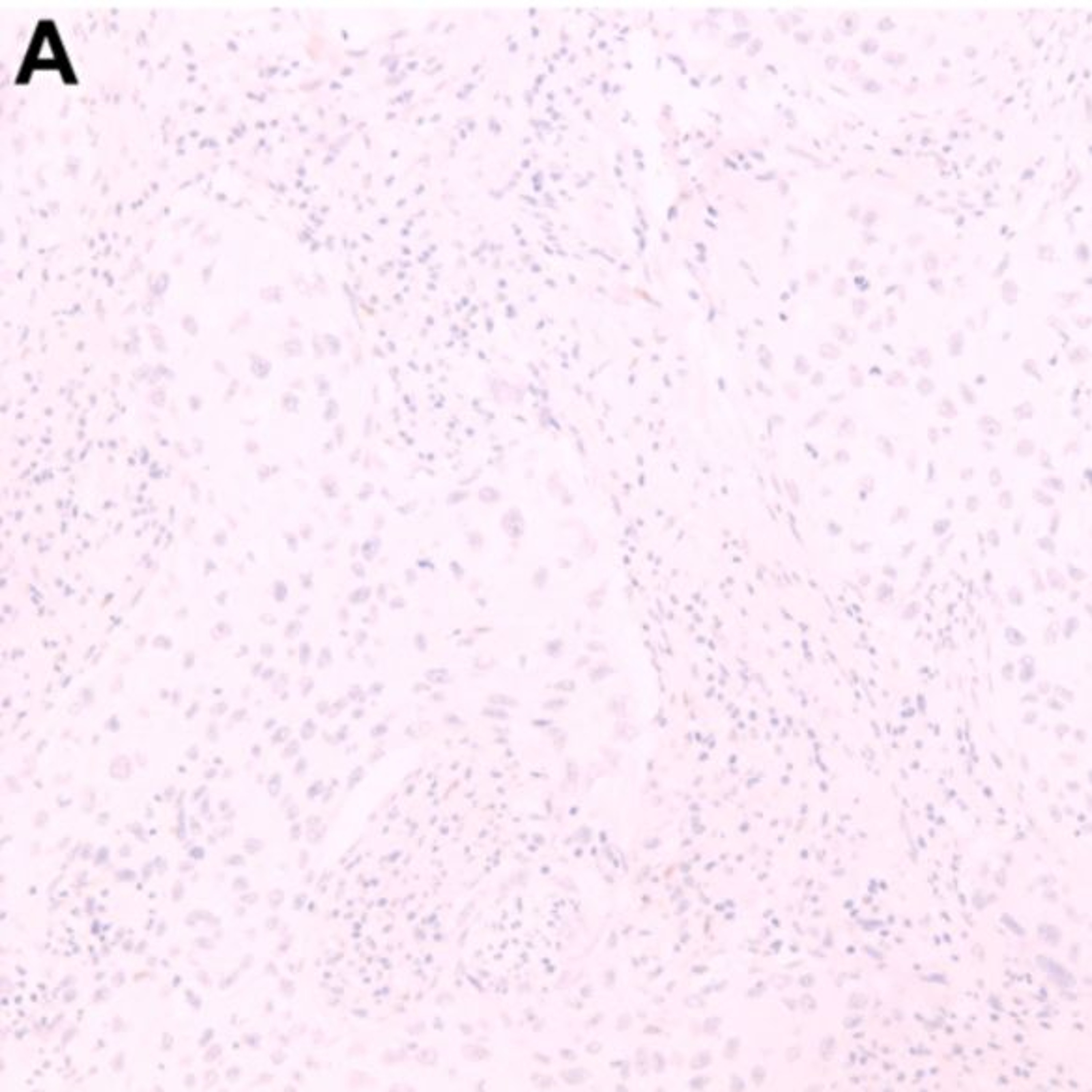 Oncotarget