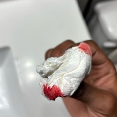 Nosebleed (Prod.Sonny)