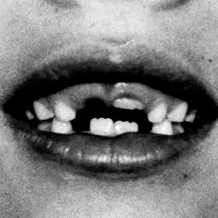 teeth feat. SOS Vince