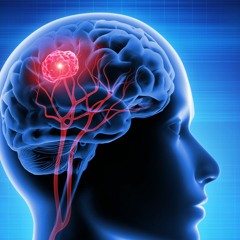 Glioma Therapy | Remove Tumor Cells & Shrink Tumor Size & Stop Headaches and Seizures