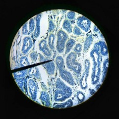 J'AI TROP LES BOULES