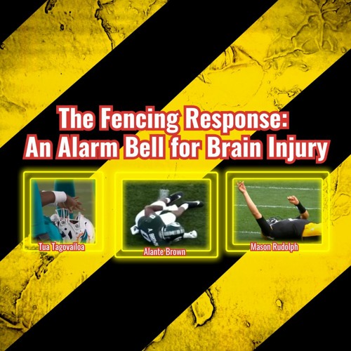 Stream episode The Fencing Response An Alarm Bell for Brain Injury by