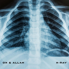 X-Ray