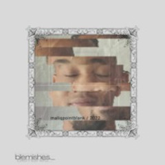 Birthmarks