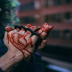 My Wounds(prod.by RFMA)