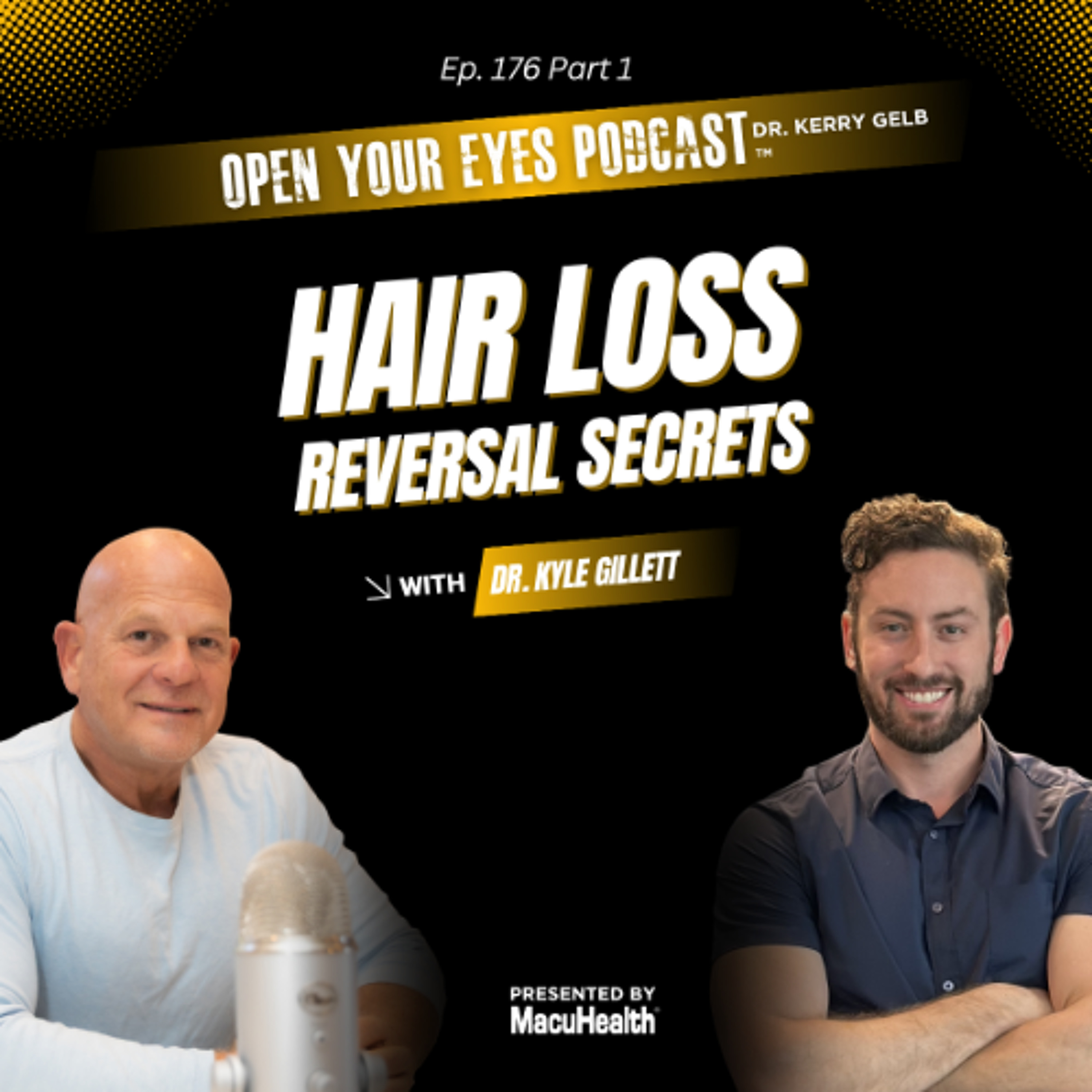 Ep. 176 Part 1 "Hair loss reversal secrets" - Dr. Kyle Gillett