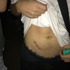 SET ESTOURA APÊNDICE - BAILE DO PG NO ZERÃO (16/08/24)