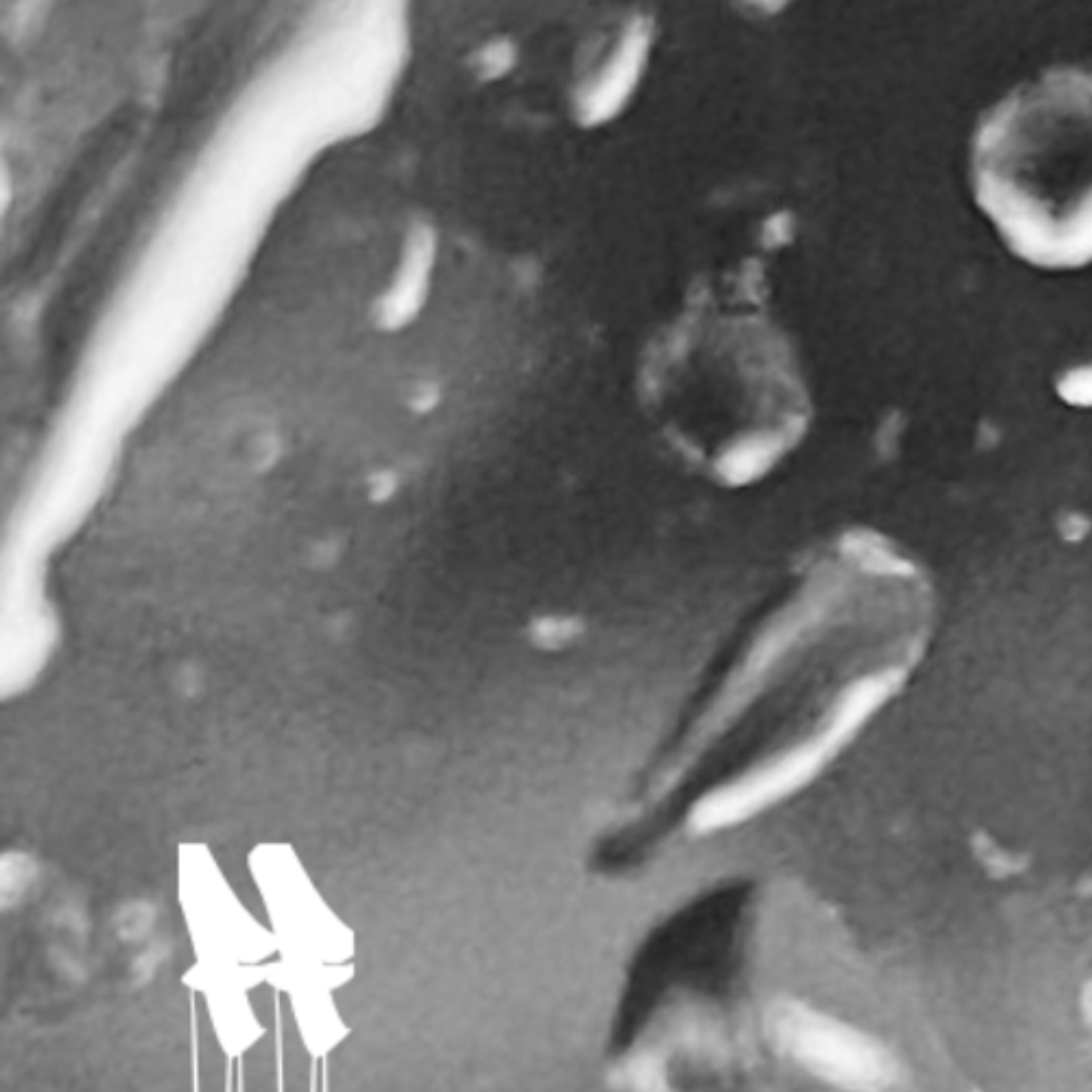 Salmo 36 episode artwork