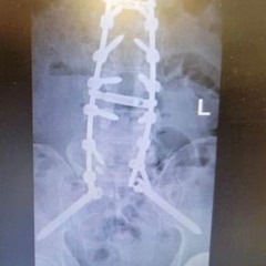 LIVING WITH PAIN.mp3