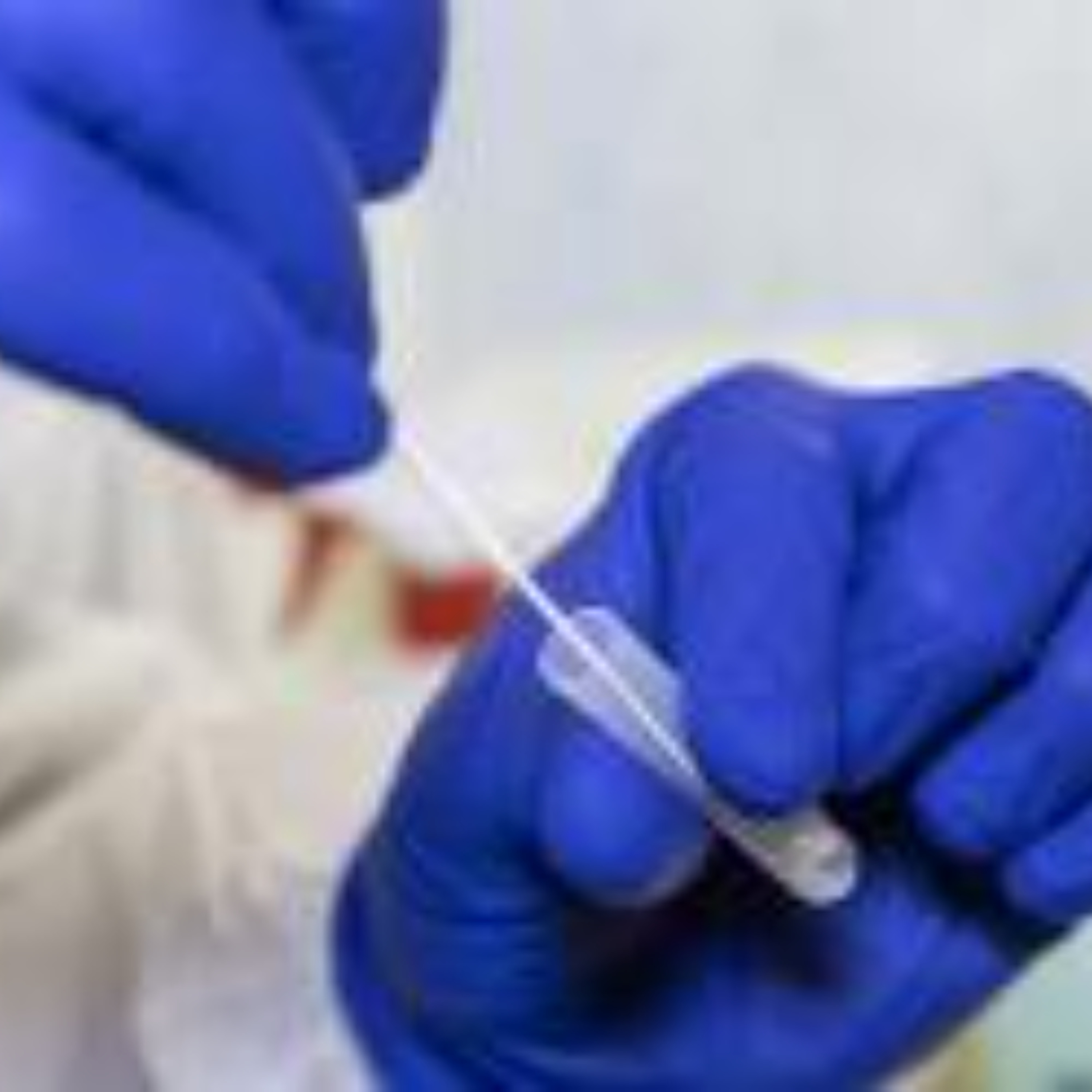 Infections en hausse  le Covid et d’autres virus refont surface !