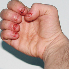 bite my nails _prod twoclose