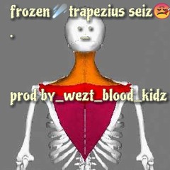 Frozen Trapezius Seiz