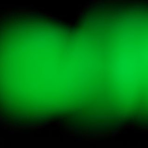 PREMIERE : Anthony Georges Patrice - Change (MLiR Remix)