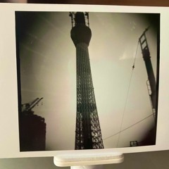 アルツハイマー