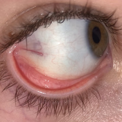 Nohy bolí víc než hlava