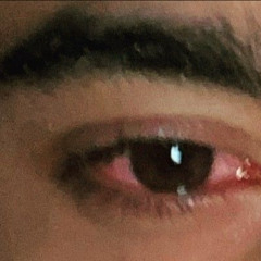 ur eyes