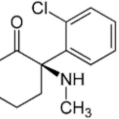 AergerLich_Live - Spacements