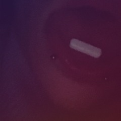 Im sick