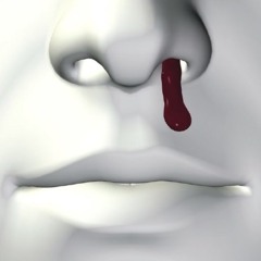 nose bleed