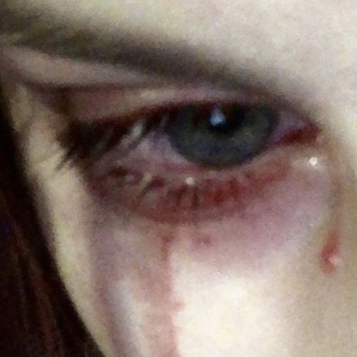 U Left Me Bleeding