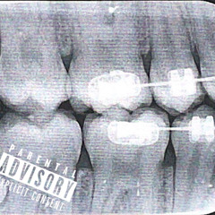 Recova [Prod. Pluto x luccid]