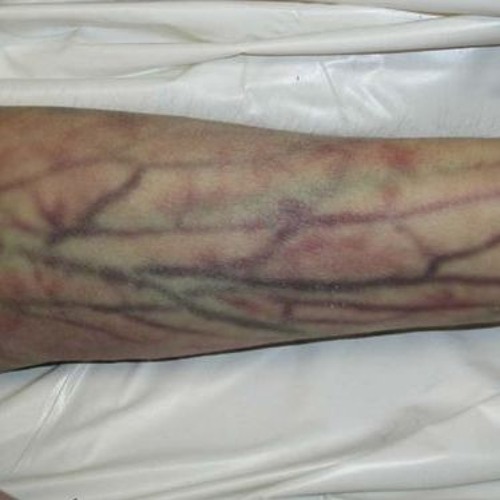 мс шприц/в уме/прививкин - 666 строк