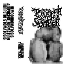 Toddler Stomper - Herpetic Stomatosis
