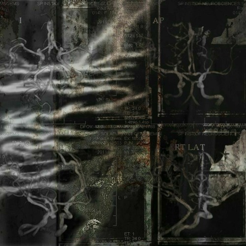 ache - think harder (reupload from the archives)