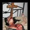 Nerven Trauma