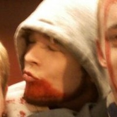 DistortD