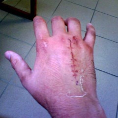 metalhand