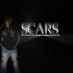 Scars