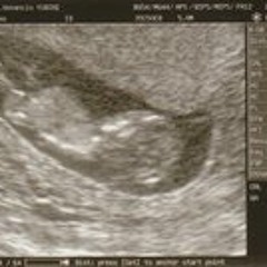 MandragorA - Iquique