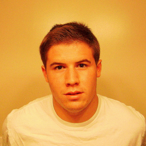 SUBURBAN SCUM-SELF LOATHING