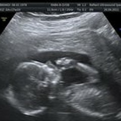 Brandi Betz Vanderneut