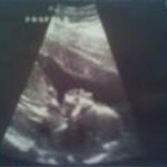 Staretha Lovingme Hopkins