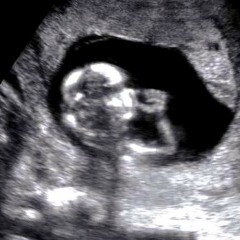 West Virginians for Life