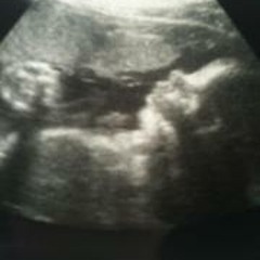 Felicity Kirkpatrick